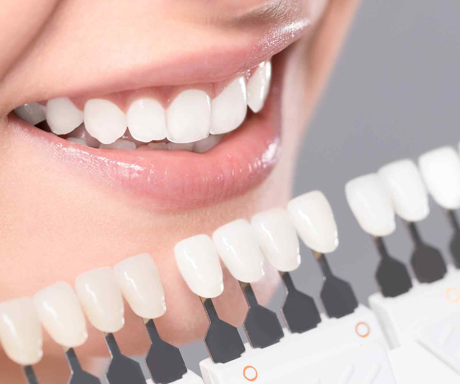 https://www.drmdentalclinique.ro/wp-content/uploads/2021/10/card_image_home_03-01.jpg