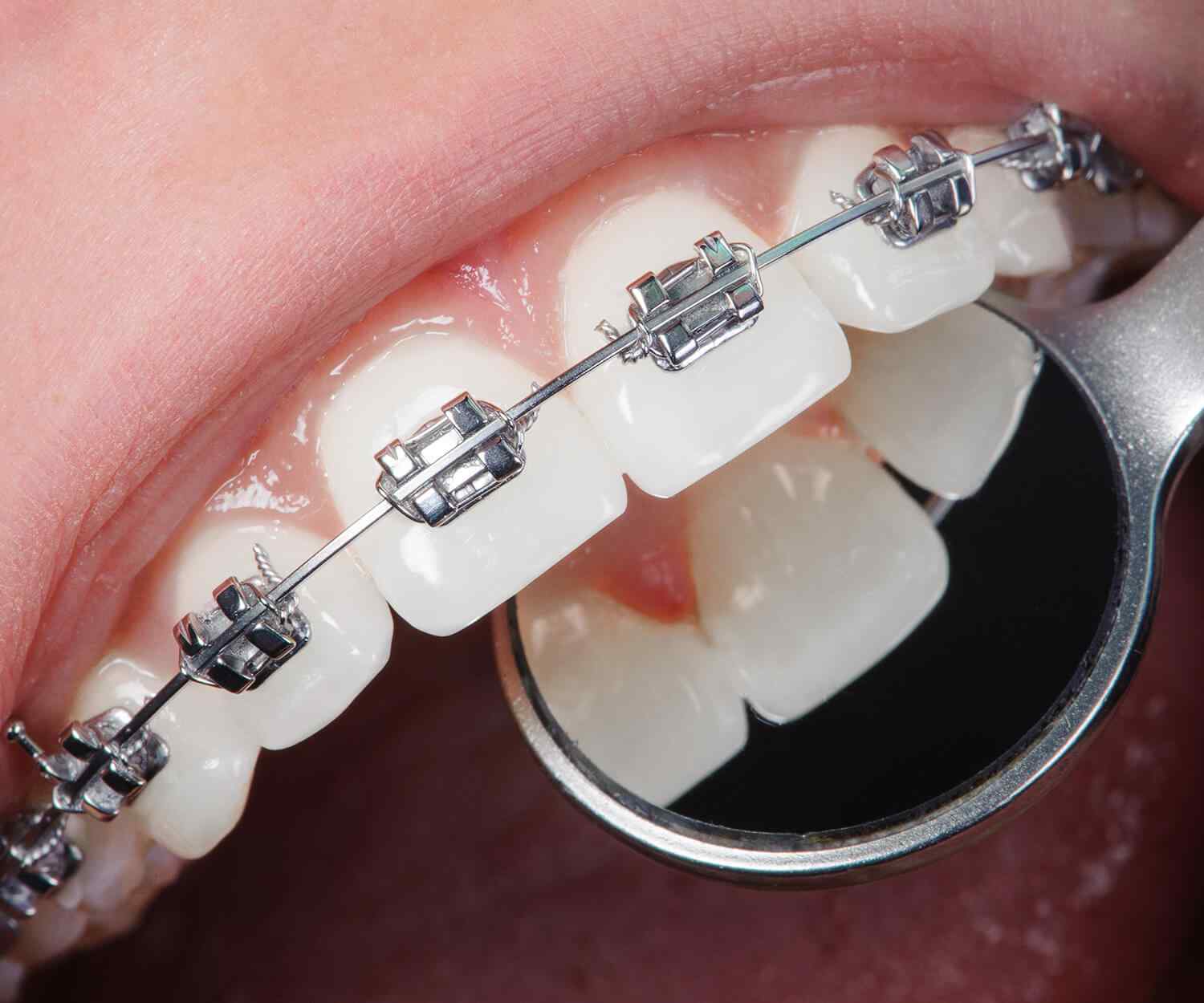 https://www.drmdentalclinique.ro/wp-content/uploads/2021/10/card_image_home_03-03.jpg