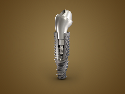 https://www.drmdentalclinique.ro/wp-content/uploads/2022/03/neodent-card-gm-implant.png